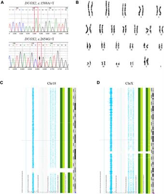 Case report: A reciprocal translocation-free and pathogenic DUOX2 mutation-free embryo selected by complicated preimplantation genetic testing resulted in a healthy live birth